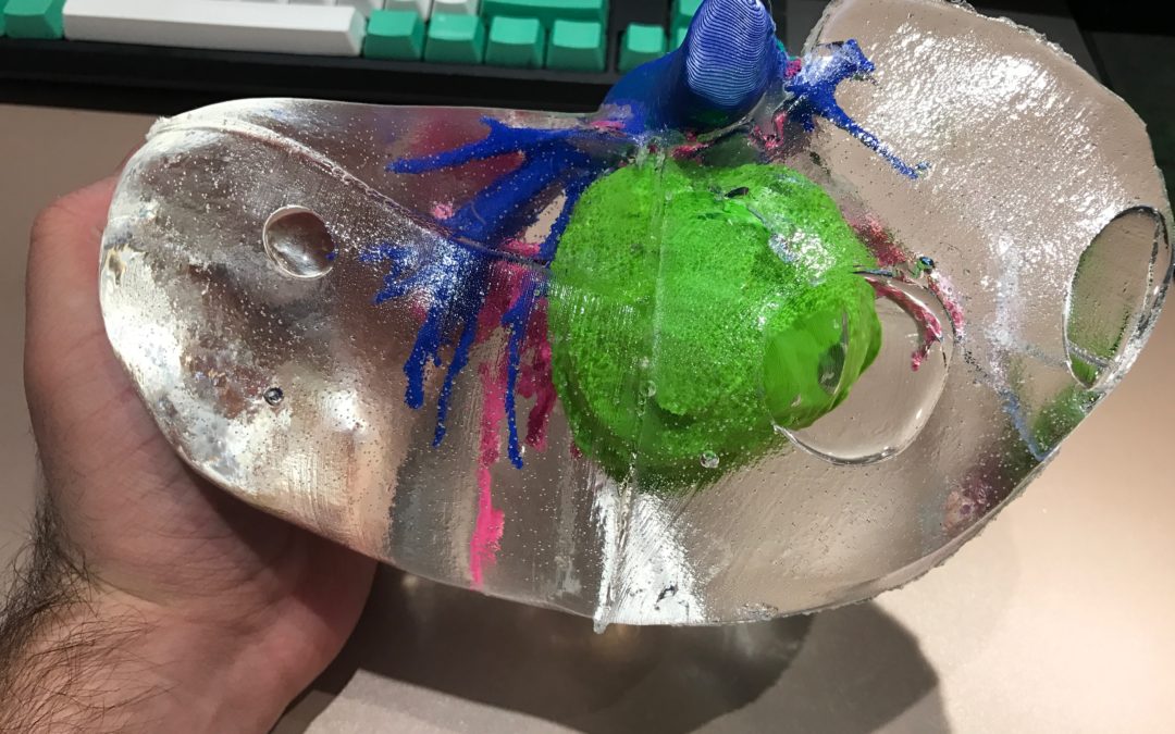 Создание модели человеческой печени на 3D-принтере обошлось в $150
